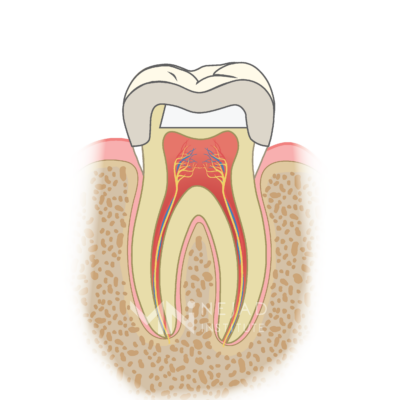 The Tooth Cycle of Death - Nejad Institute for Biomimetic Dentistry